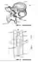 Fig. 04 - Implantable orthopedic device component selection instrument and methods