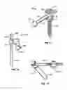 Fig. 05 - Implantable orthopedic device component selection instrument and methods