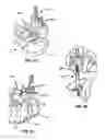 Fig. 06 - Implantable orthopedic device component selection instrument and methods