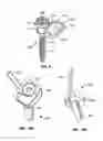 Fig. 07 - Implantable orthopedic device component selection instrument and methods