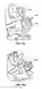 Fig. 09 - Implantable orthopedic device component selection instrument and methods