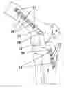 Fig. 01 - Knee hinge fixation apparatus and method for application thereof