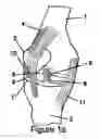 Fig. 02 - Knee hinge fixation apparatus and method for application thereof