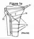 Fig. 06 - Knee hinge fixation apparatus and method for application thereof