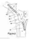 Fig. 07 - Knee hinge fixation apparatus and method for application thereof