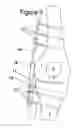 Fig. 08 - Knee hinge fixation apparatus and method for application thereof