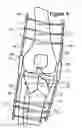 Fig. 09 - Knee hinge fixation apparatus and method for application thereof