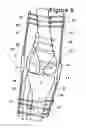 Fig. 10 - Knee hinge fixation apparatus and method for application thereof