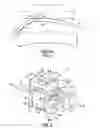 Fig. 02 - Orthodontic bracket and method of correcting malpositioned teeth