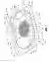 Fig. 02 - Packaging for a hernia repair device