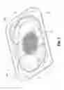 Fig. 07 - Packaging for a hernia repair device
