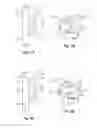 Fig. 05 - Methods and apparatus for filtering a body lumen