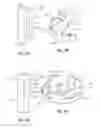 Fig. 06 - Methods and apparatus for filtering a body lumen