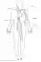Fig. 10 - Methods and apparatus for filtering a body lumen