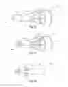 Fig. 12 - Methods and apparatus for filtering a body lumen