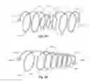 Fig. 13 - Methods and apparatus for filtering a body lumen