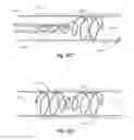 Fig. 17 - Methods and apparatus for filtering a body lumen