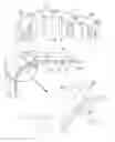 Fig. 03 - Medical device lock mechanism