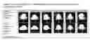 Fig. 02 - Fatty acid pharmaceutical foam
