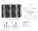 Fig. 12 - Peptide conjugated particles for the treatment of allergy