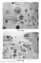 Fig. 02 - Dosage form comprising an active ingredient and a plurality of solid porous microcarriers