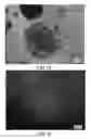 Fig. 04 - Dosage form comprising an active ingredient and a plurality of solid porous microcarriers