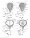 Fig. 02 - Methods for treatment of bladder cancer