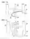 Fig. 07 - Apparatus and methods for preventing or treating failure of hemodialysis vascular access and other vascular grafts