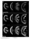 Fig. 08 - Treating Hearing Loss