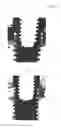 Fig. 07 - OSSEO-INDUCTIVE METAL IMPLANTS FOR A LIVING BODY AND THE PRODUCING METHOD THEREOF