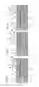 Fig. 07 - INJECTION DEVICE FOR METERING AND DISCHARGING A FIXED DOSE OF A LIQUID PRODUCT