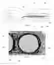 Fig. 08 - Devices and methods for forming vascular access