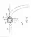 Fig. 06 - Compressible connector for an inner cannula