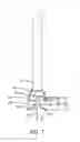 Fig. 08 - Compressible connector for an inner cannula