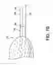 Fig. 09 - Oral suction device