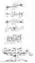 Fig. 02 - Device for securing a breathing tube and method of manufacturing the same