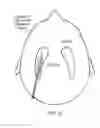 Fig. 06 - Neurosurgical apparatus and method
