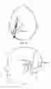Fig. 07 - Neurosurgical apparatus and method