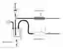 Fig. 01 - Apparatus for extracting and re-injecting adipose tissue