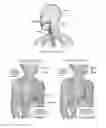 Fig. 02 - Controlling coughing and swallowing
