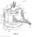 Fig. 06 - Preferential therapeutic modulation without patient-perceived paresthesia