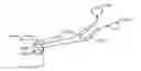 Fig. 01 - Method of stimulating a hypoglossal nerve for controlling the position of a patient's tongue