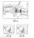 Fig. 02 - Method of stimulating a hypoglossal nerve for controlling the position of a patient's tongue