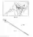 Fig. 07 - Method of stimulating a hypoglossal nerve for controlling the position of a patient's tongue