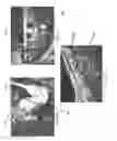 Fig. 07 - Manipulation of imaging probe during medical procedure
