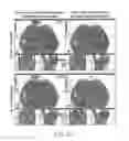 Fig. 35 - Manipulation of imaging probe during medical procedure
