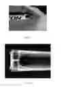 Fig. 09 - Tamper Evident Detection Device