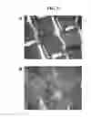 Fig. 07 - POROUS METALLIC STRUCTURES
