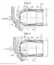 Fig. 02 - Cable device to restrict headlamp motion in frontal low speed impacts