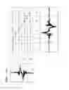 Fig. 08 - Method and apparatus for determining road surface condition